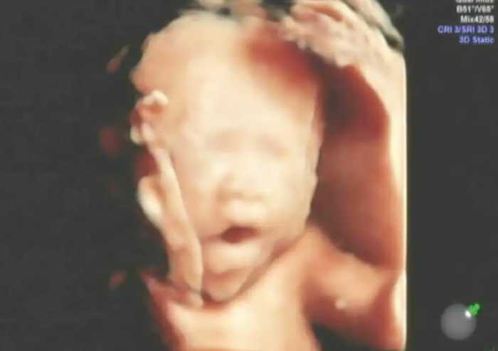 孕期胎儿的四维图像，就是出生时候的模样？别急，后面可能有惊喜