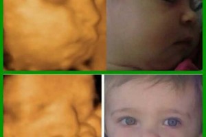出生前 vs 出生后，胎儿四维B超影像与宝宝出生后对比，太神奇