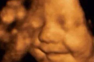 怀孕5个半月做四维彩超，看到胎儿咧嘴微笑，孕妇既惊喜又惊讶